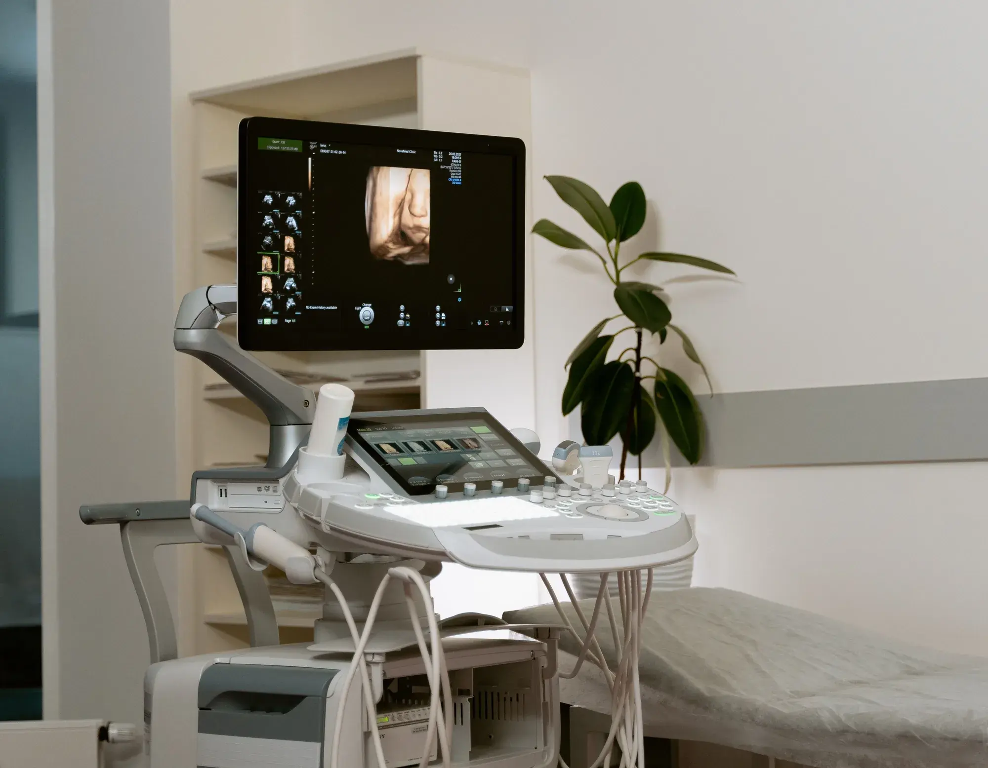 Ultraschallgerät mit Monitor und Bedienpult in einem Untersuchungsraum.